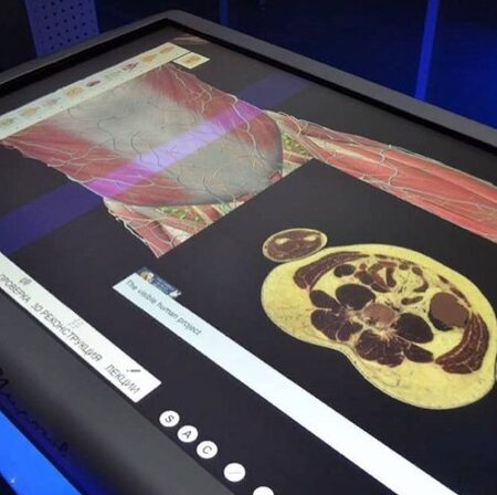 Вологодский медицинский колледж оснастили интерактивным анатомическим столом Пирогова