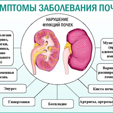 Обнаружен неожиданный признак хронического заболевания почек