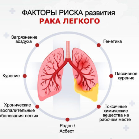 Связь привычных продуктов с риском рака легких