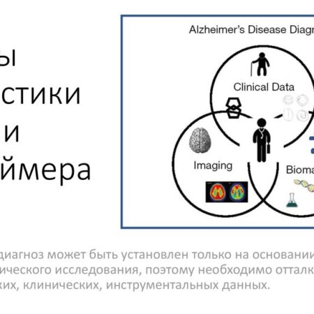 Прорыв в ранней диагностике болезни Альцгеймера