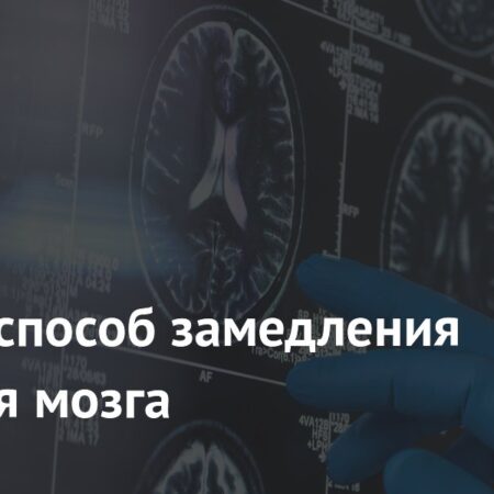 Открыт потенциальный ключ к замедлению старения мозга