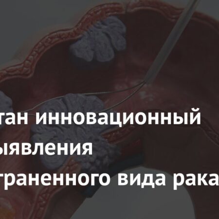 Разработан инновационный метод выявления распространенного вида рака