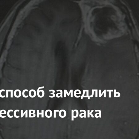 Ученые обнаружили метод замедления прогрессирования агрессивного рака мозга