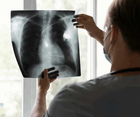 Белок ApoD: ключевой фактор уязвимости пожилых к гриппу