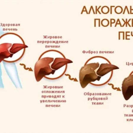 Природный путь к восстановлению печени после алкоголя без медикаментов