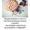 Плохой сон назван ключевым фактором ускоренного старения мозга