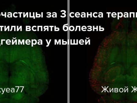 Революция в терапии: Наночастицы успешно обратили болезнь Альцгеймера вспять