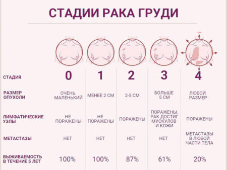 Нарушение циркадных ритмов ускоряет развитие и метастазирование рака молочной железы