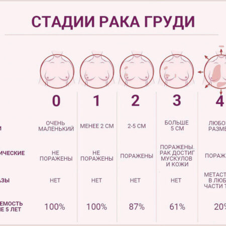 Нарушение циркадных ритмов ускоряет развитие и метастазирование рака молочной железы