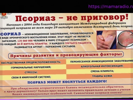 Можно ли вылечить псориаз? Объясняет дерматолог